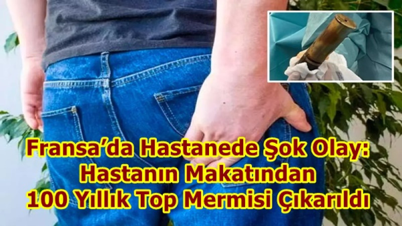 Fransa’da Hastanede Şok Olay: Hastanın Makatından 100 Yıllık Top Mermisi Çıkarıldı